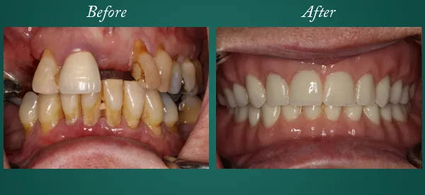 Before and After Image 14