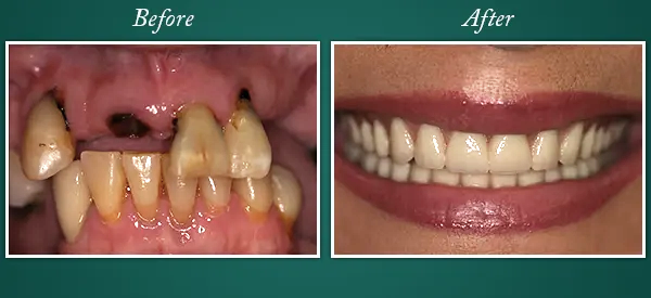 Before & After 3
