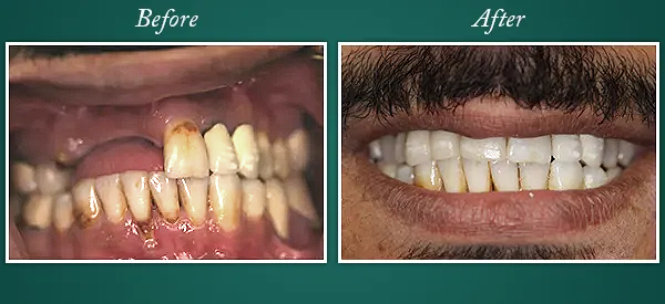 Before & After 7