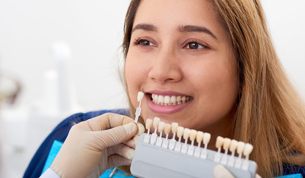Porcelain Veneers Fresno